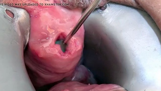 Stim99's eyehole fucked brutally with a huge dildo